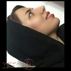 جراحی-بینی-21