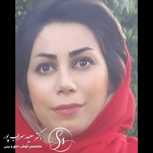 جراحی-بینی-32