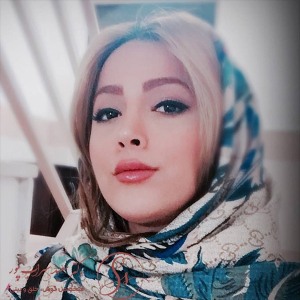 جراحی-بینی-33