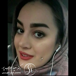 جراحی-بینی-39
