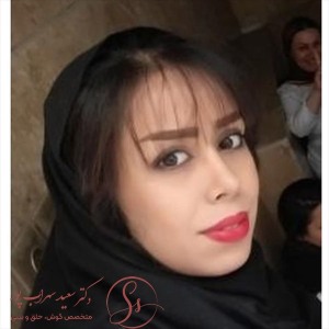 جراحی-بینی-59