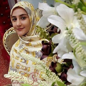 جراحی-بینی-60