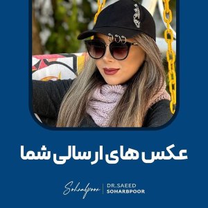 جراحی-بینی-78