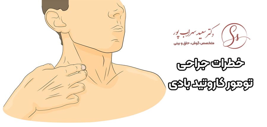خطرات جراحی تومور کاروتید بادی