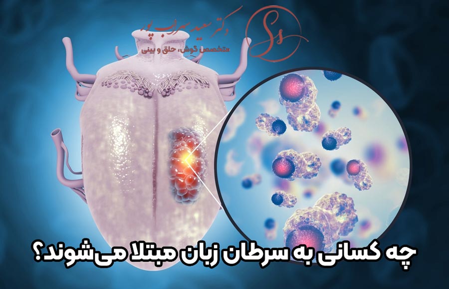 علل سرطان زبان
