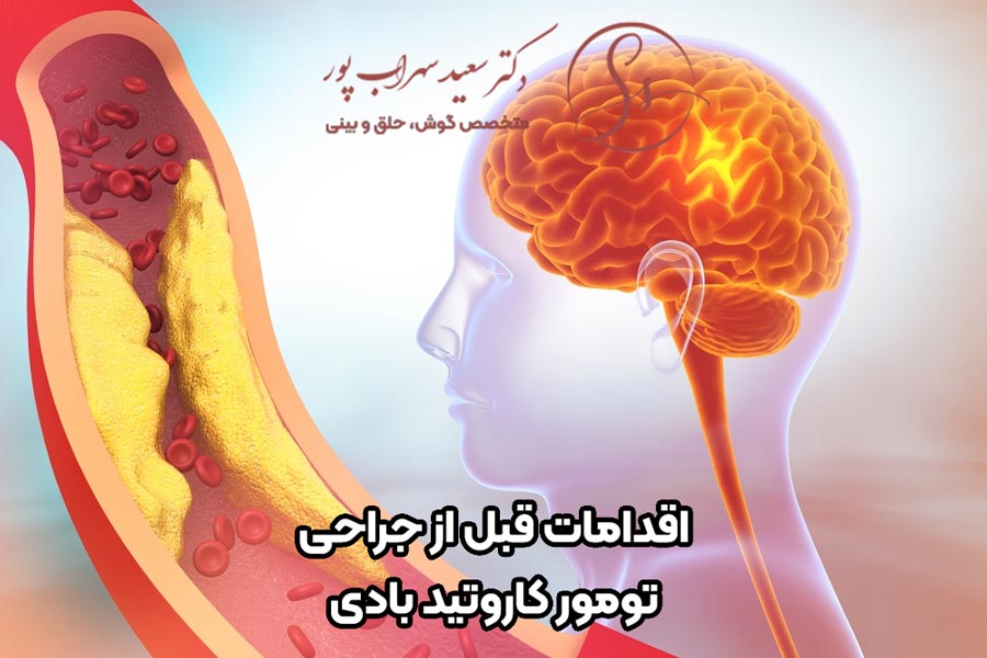 اقدامات پیش از جراحی تومور کاروتید بادی