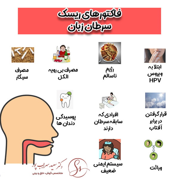 فاکتورهای ریسک سرطان زبان