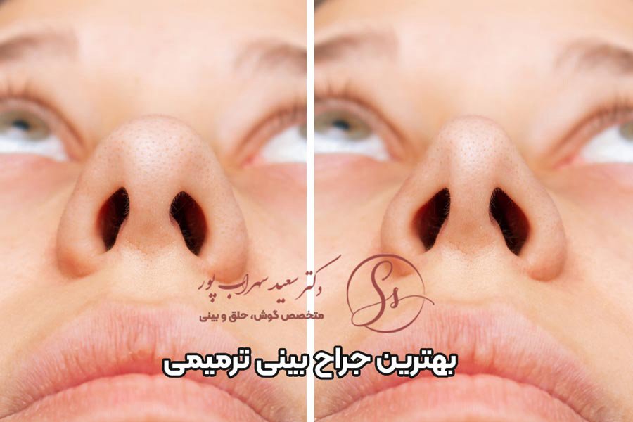 بهترین جراح بینی ترمیمی تهران