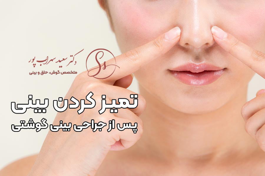 جراحی بینی گوشتی - دکتر سهراب پور