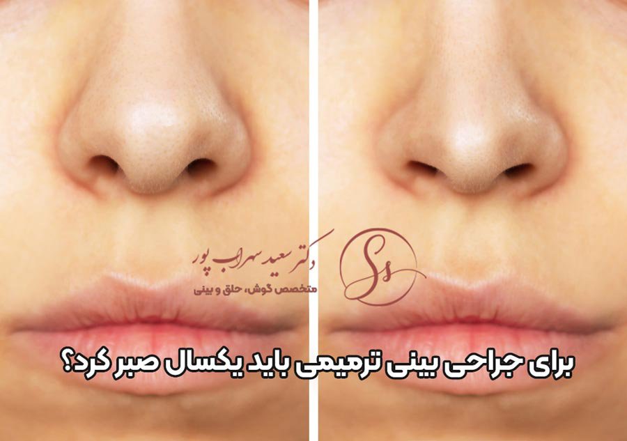 عمل ترمیمی بینی