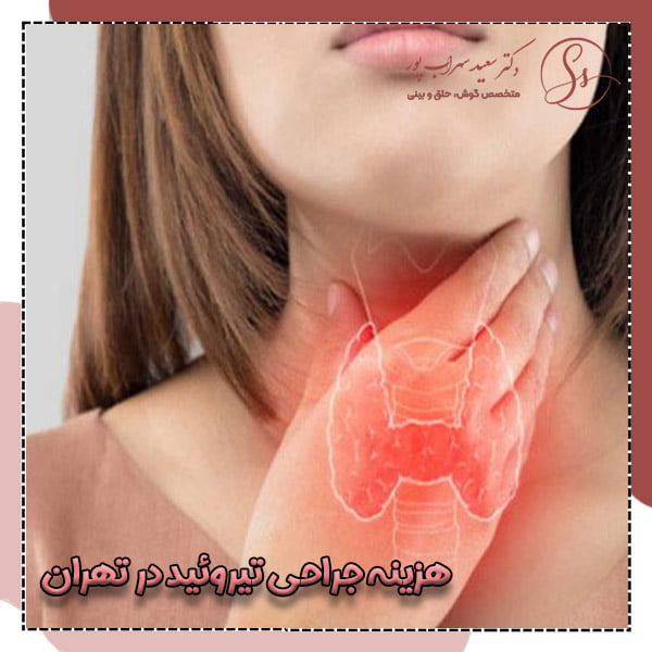 هزینه جراحی تیروئید در تهران - دکتر سهراب پور