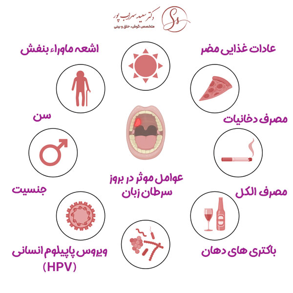 سرطان زبان + دکتر سعید سهراب پور