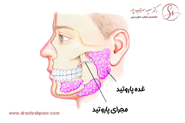 تومور غدد بزاقی + دکتر سعید سهراب پور