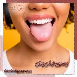 بیماری لیکن پلان چیست و چگونه درمان می شود؟