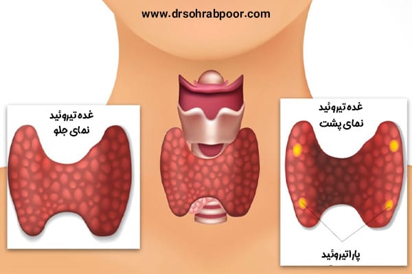 پاراتیروئید + دکتر سعید سهراب پور