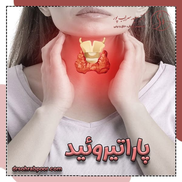 پاراتیروئید + دکتر سعید سهراب پور
