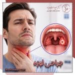جراحی لوزه و درمان لوزه سوم در تهران با دکتر سهراب پور