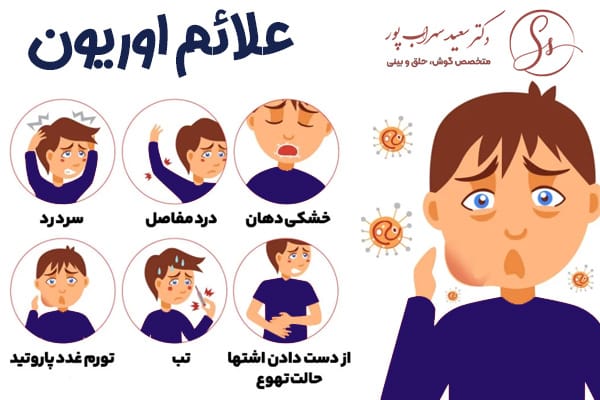 اوریون پاروتید - دکتر سعید سهراب پور