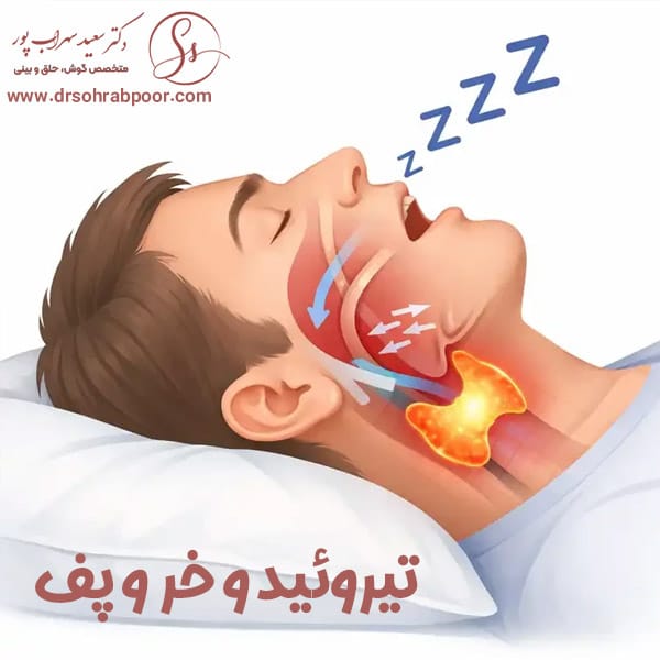 تیروئید و خر و پف + دکتر سعید سهراب پور