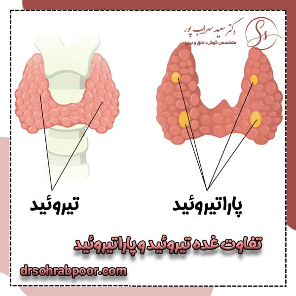 تفاوت غده تیروئید و پاراتیروئید + دکتر سعید سهراب پور
