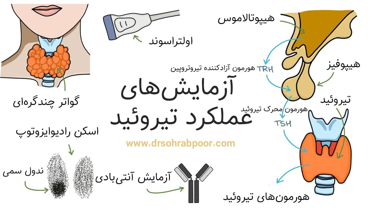 آزمایش تیروئید + دکتر سعید سهراب پور