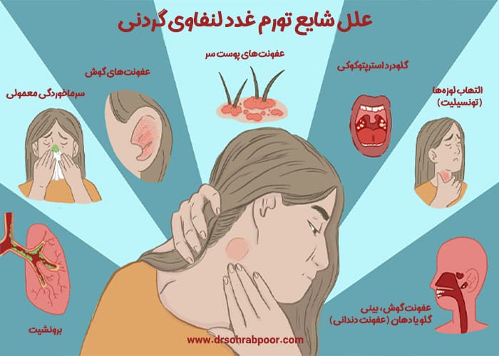 جراحی غده لنفاوی | دکتر سعید سهراب پور