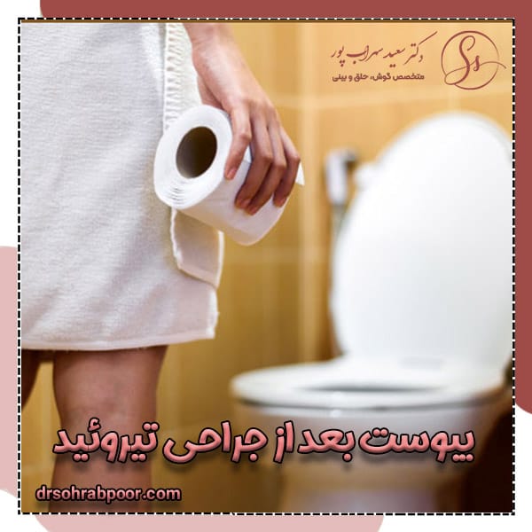 یبوست بعد از جراحی تیروئید + دکتر سعید سهراب پور