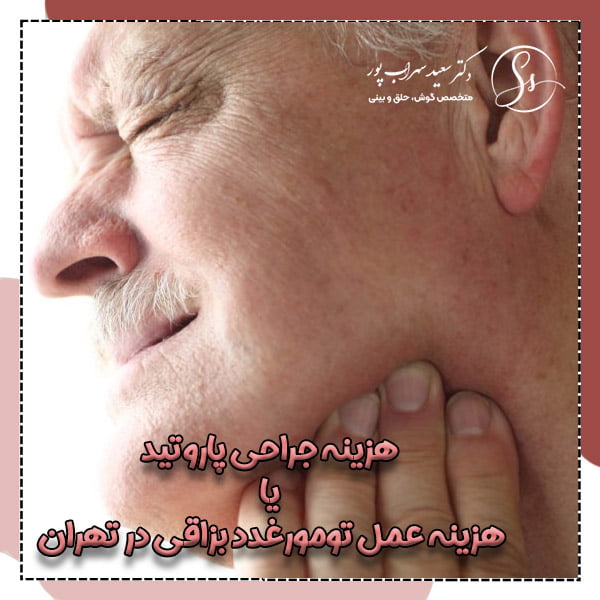 هزینه جراحی پاروتید در تهران - دکتر سهراب پور