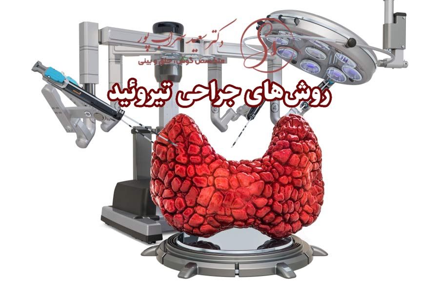 روش های جراحی تیروئید