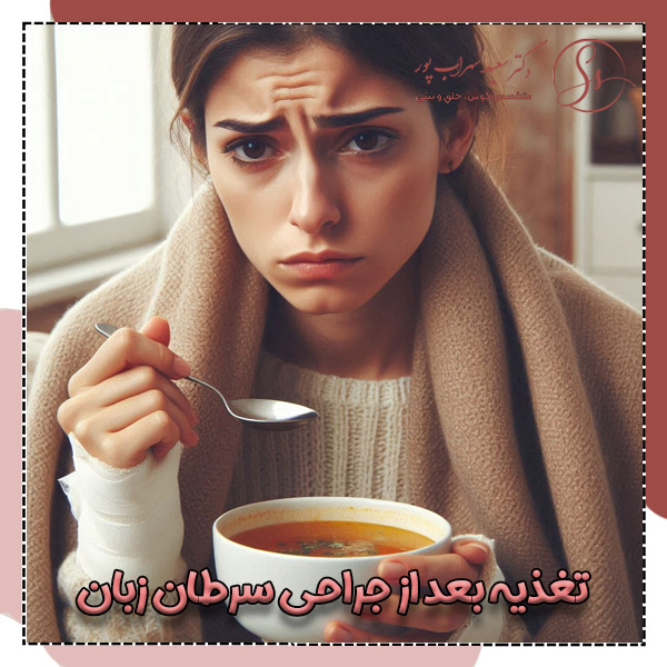 تغذیه بعد از جراحی سرطان زبان + دکتر سعید سهراب پور