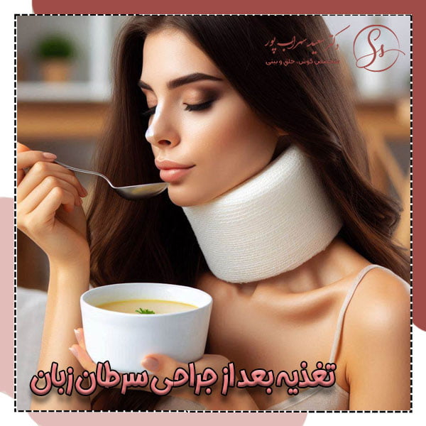 تغذیه بعد از جراحی سرطان زبان - دکتر سهراب پور