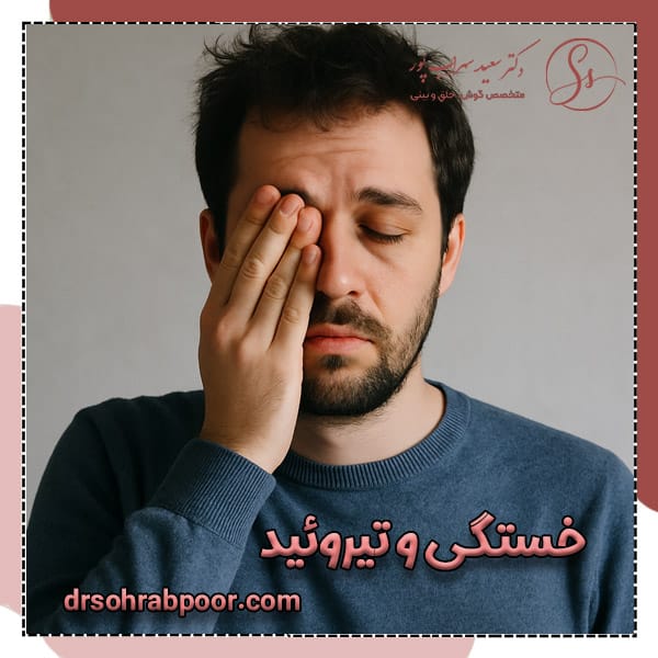 خستگی و تیروئید + دکتر سعید سهراب پور