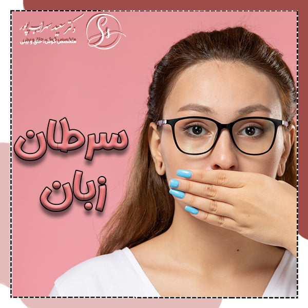 سرطان زبان - دکتر سهراب پور